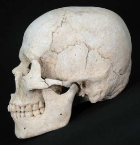  Signs of cranial deformation in the skulls of Hirota site, Tanegashima Island